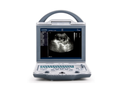 Rechargeable Human Ultrasound Scanner -KX5600