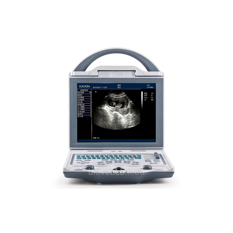 Rechargeable Human Ultrasound Scanner -KX5600